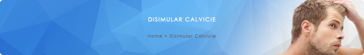 Disimular Calvicie Disimular Calvicie
