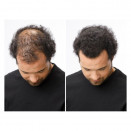 Antes y después densificador toppik 55g
