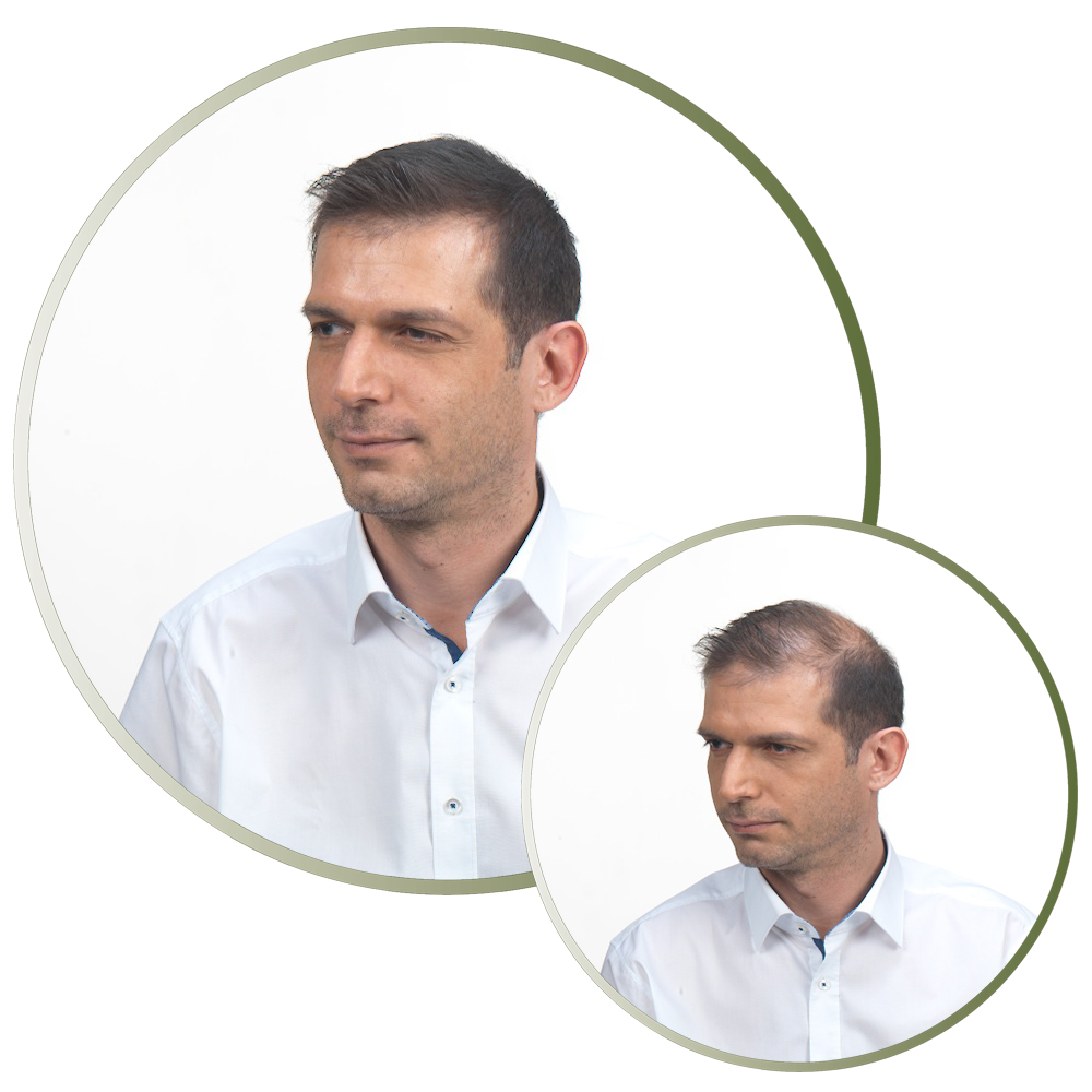 fibras-capilares-antes-depois-opinioes